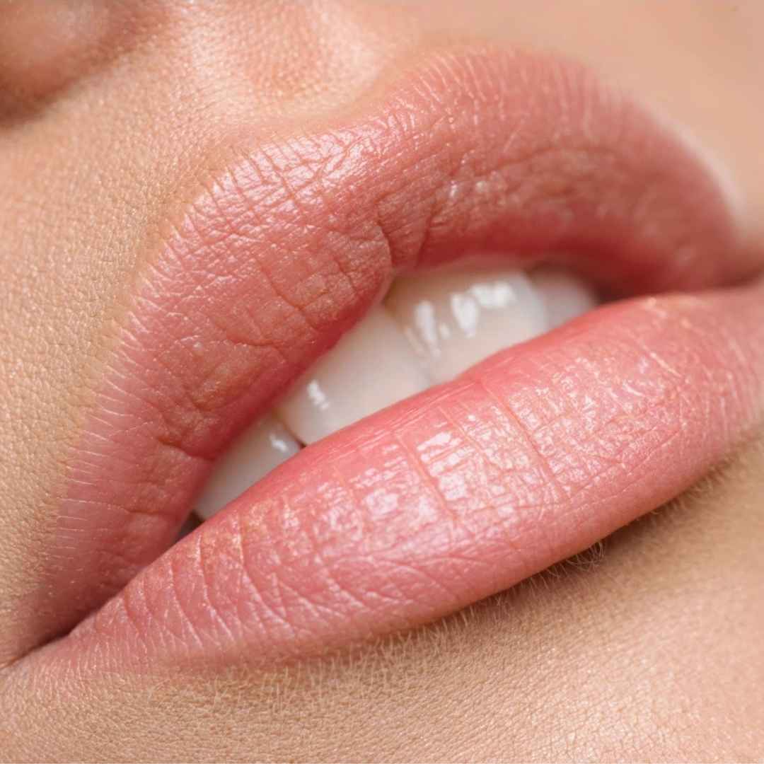 lip filler aesthetic treatment